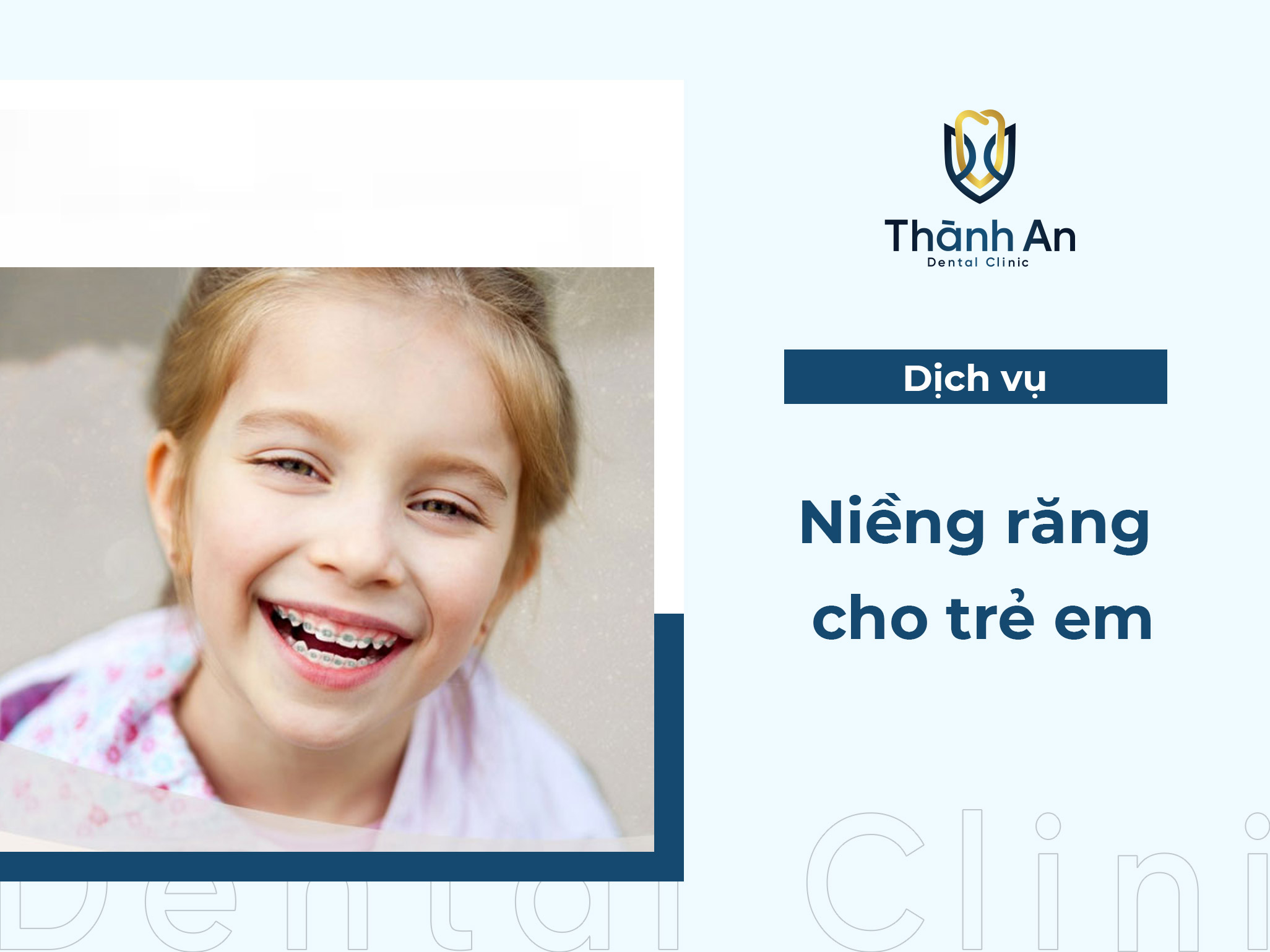 Niềng răng trẻ em UY TÍN - AN TOÀN tại Nha khoa Thành An