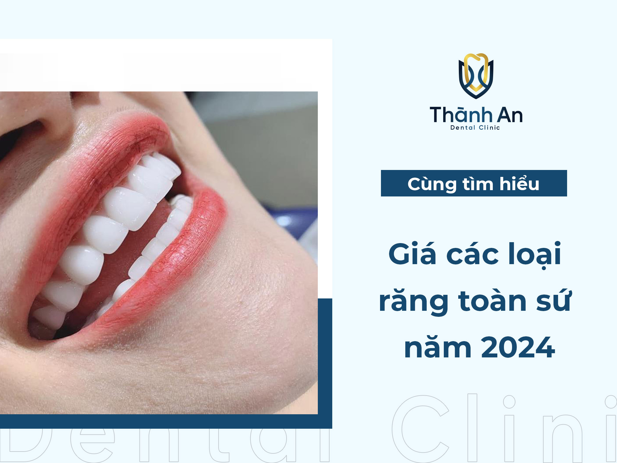 Răng Toàn Sứ Là Gì? Giá các loại răng toàn sứ năm 2024