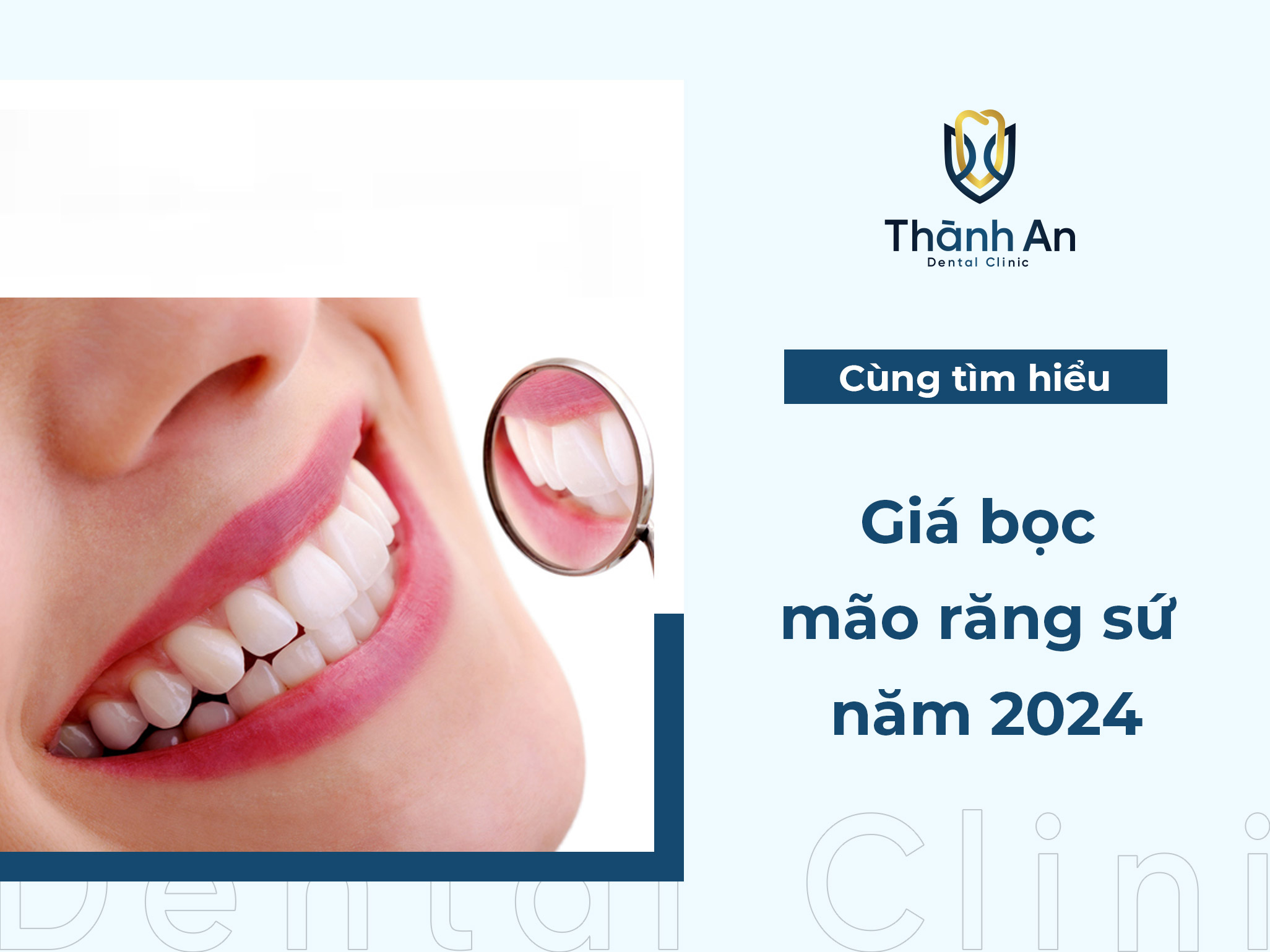 Mão răng sứ là gì? Phân loại và giá bọc mão răng sứ năm 2024