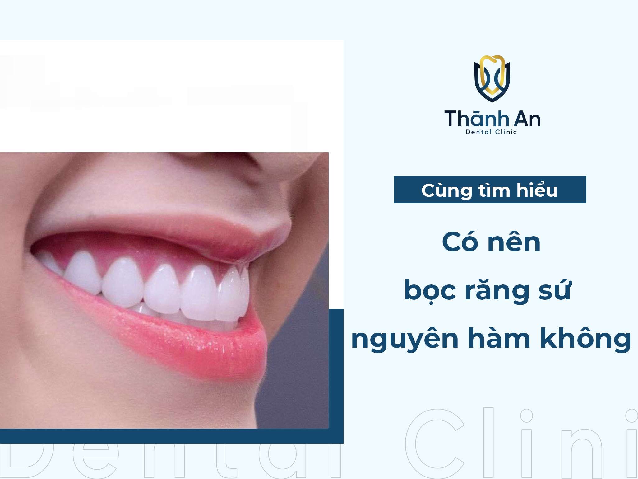  Có nên bọc răng sứ nguyên hàm không? Lợi ích và rủi ro bạn cần biết