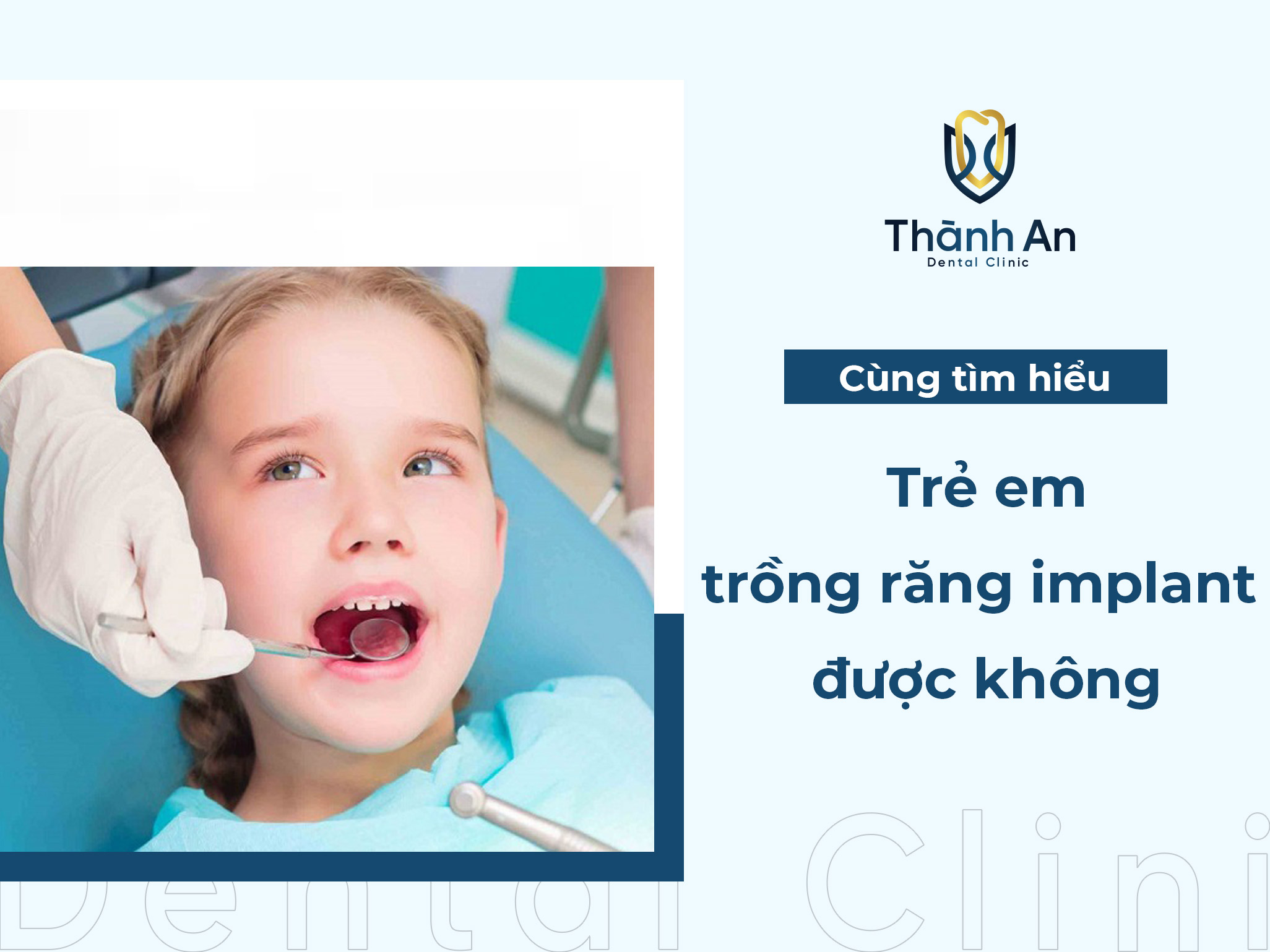 Trẻ em có trồng răng implant được không?