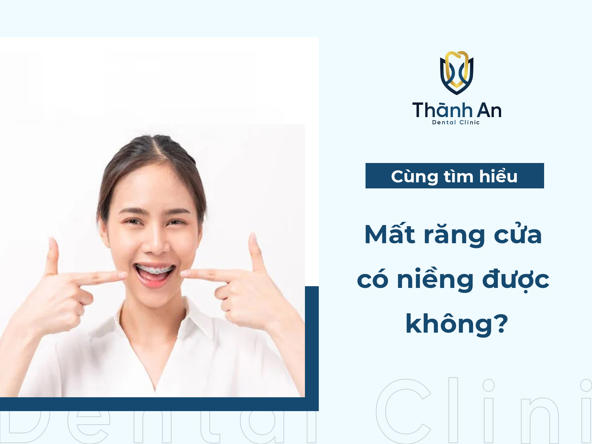 Mất răng cửa có niềng được không?