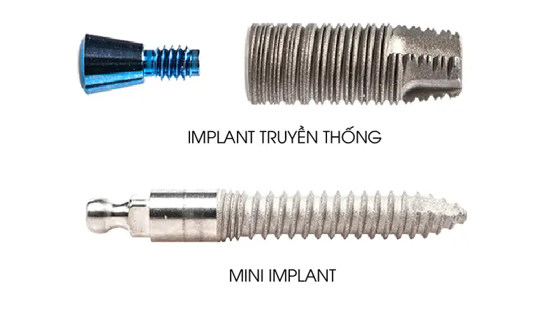 mini-implant
