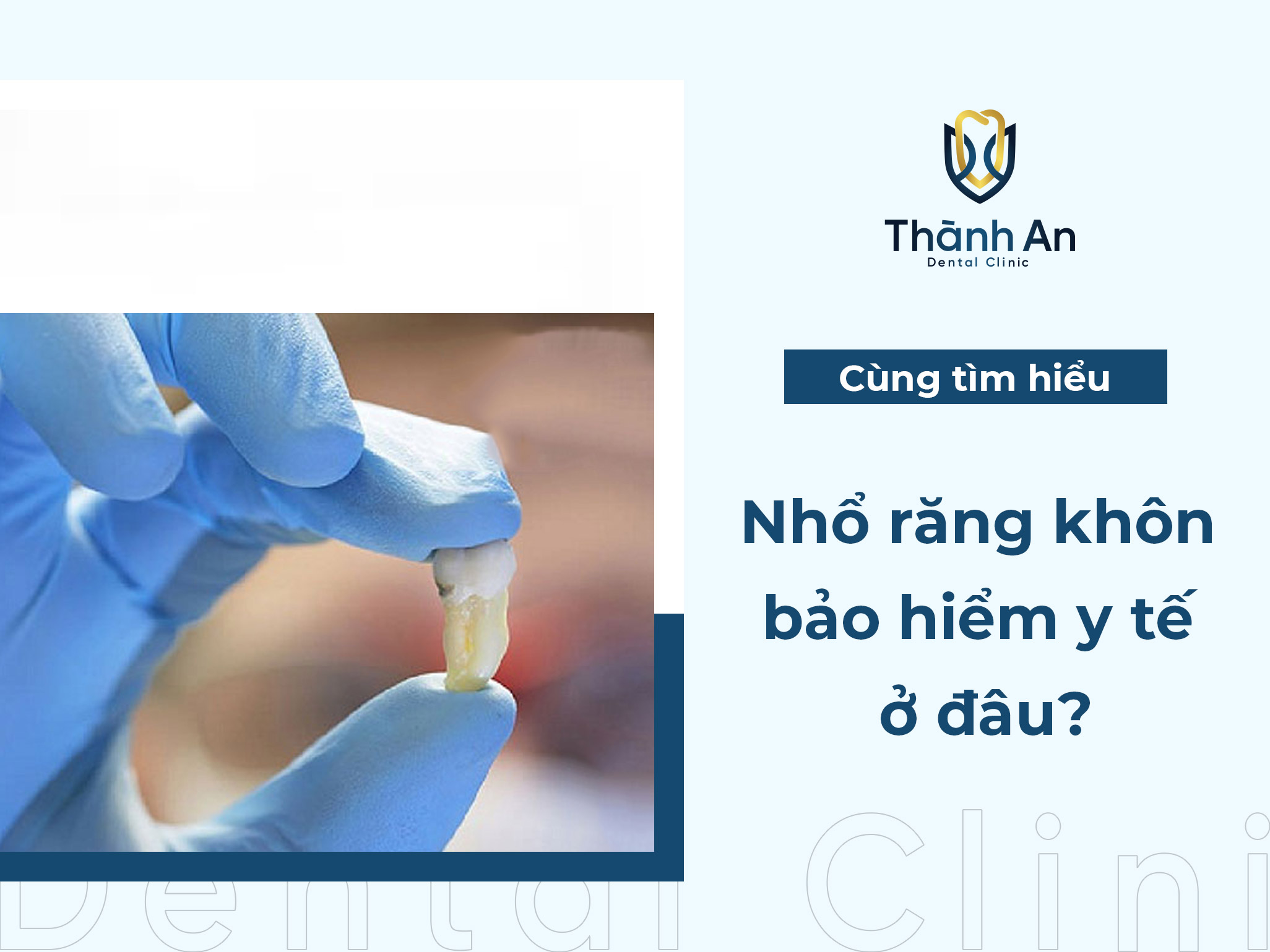 Nhổ răng khôn bảo hiểm y tế ở đâu? [Xem ngay]