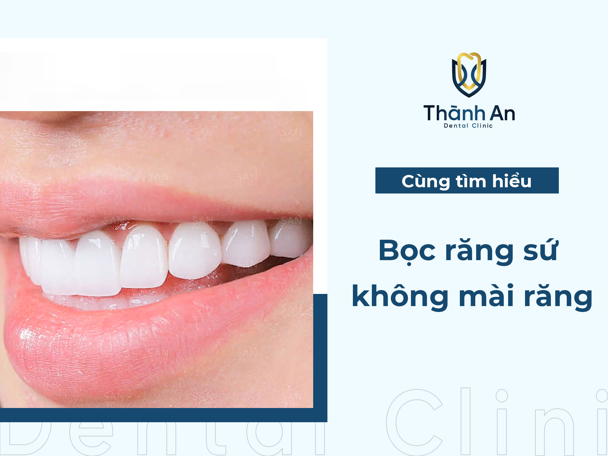 Bọc răng sứ không mài răng: Thực hư hiệu quả thế nào?