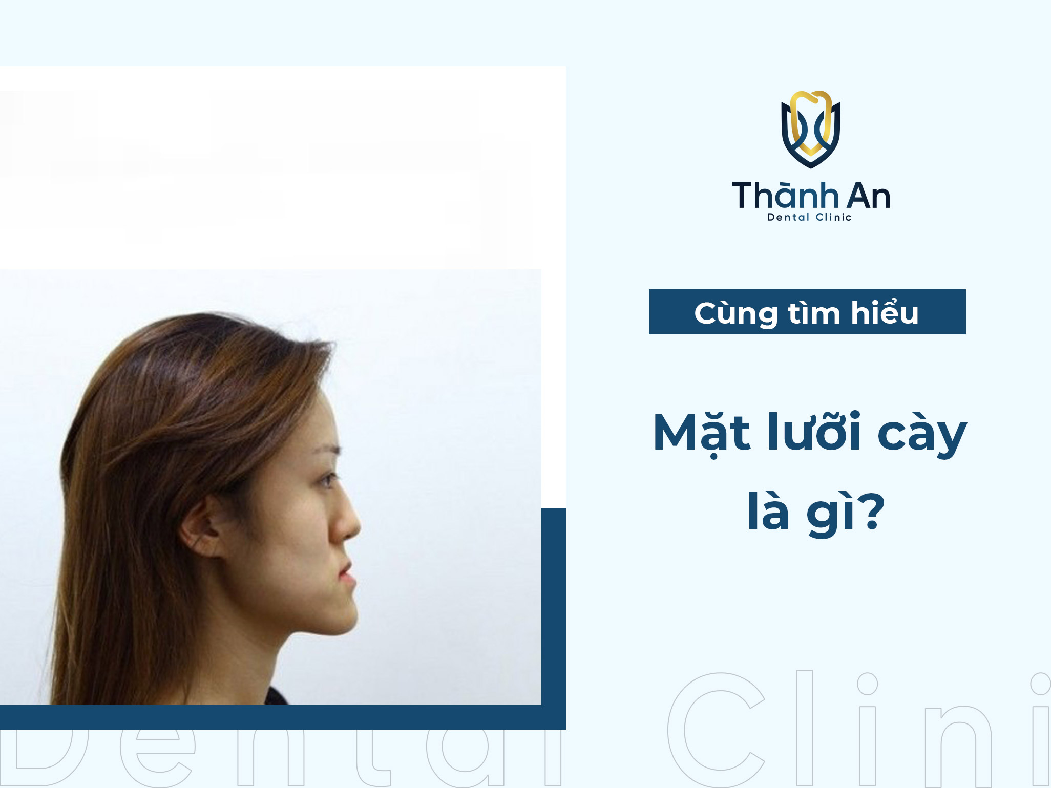 Khuôn mặt lưỡi cày là gì? Tướng số và cách khắc phục mặt gãy HIỆU QUẢ