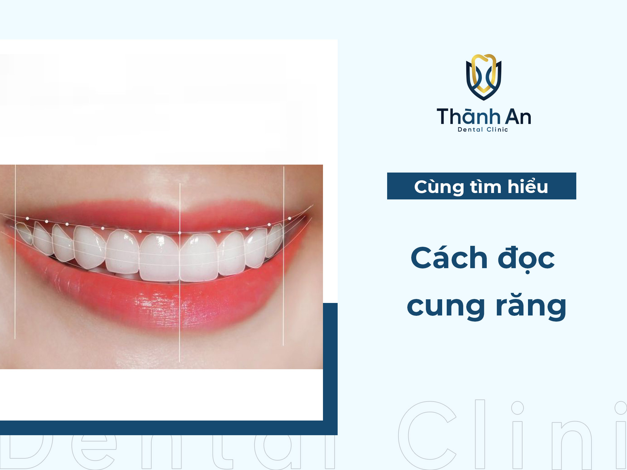 Cung răng là gì? Đặc điểm và cách đọc cung răng chuẩn chi tiết