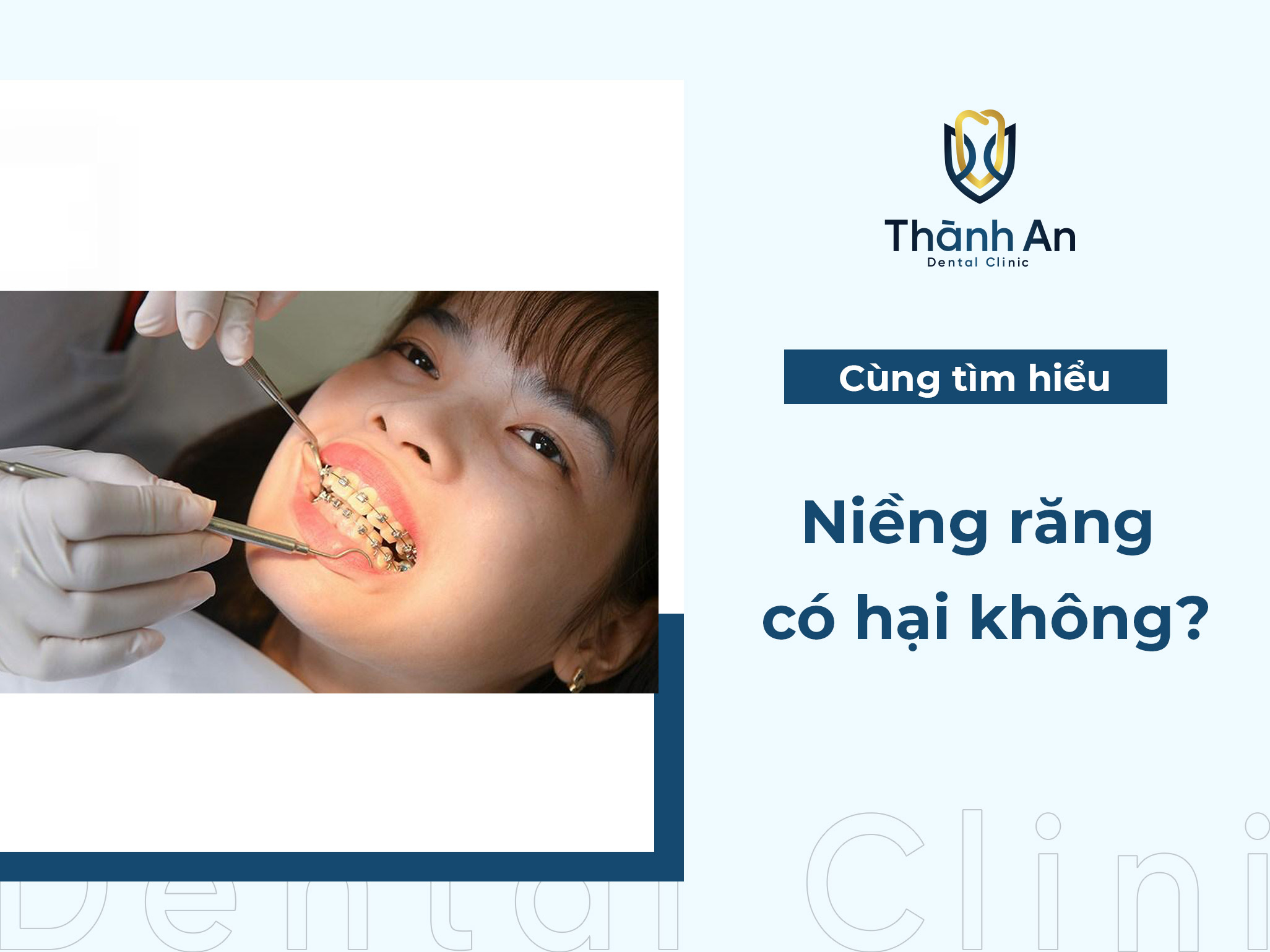Niềng răng có hại không? Ảnh hưởng đến sức khỏe răng miệng như thế nào?