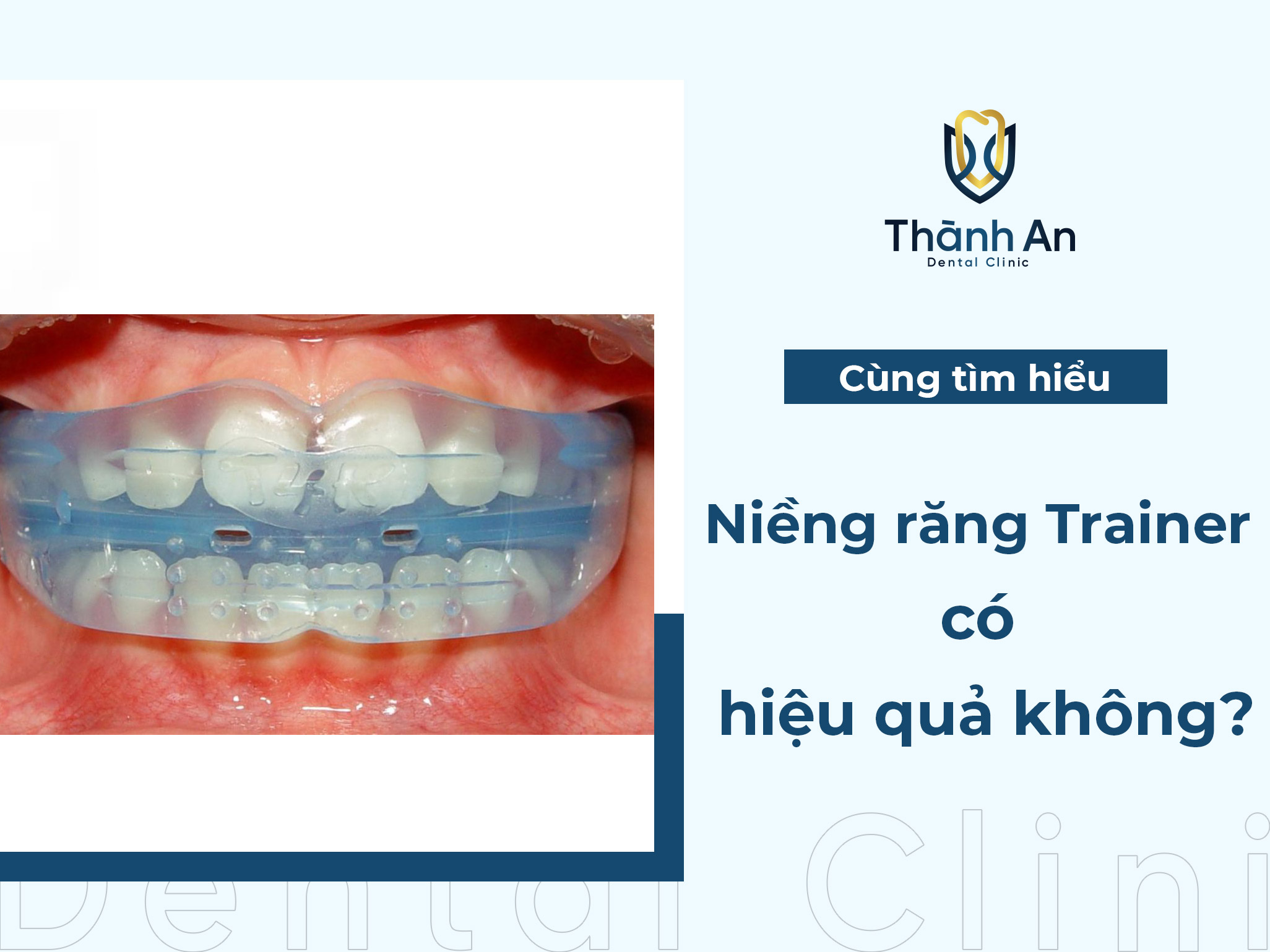 [Hỏi- Đáp] Niềng răng Trainer có hiệu quả không?