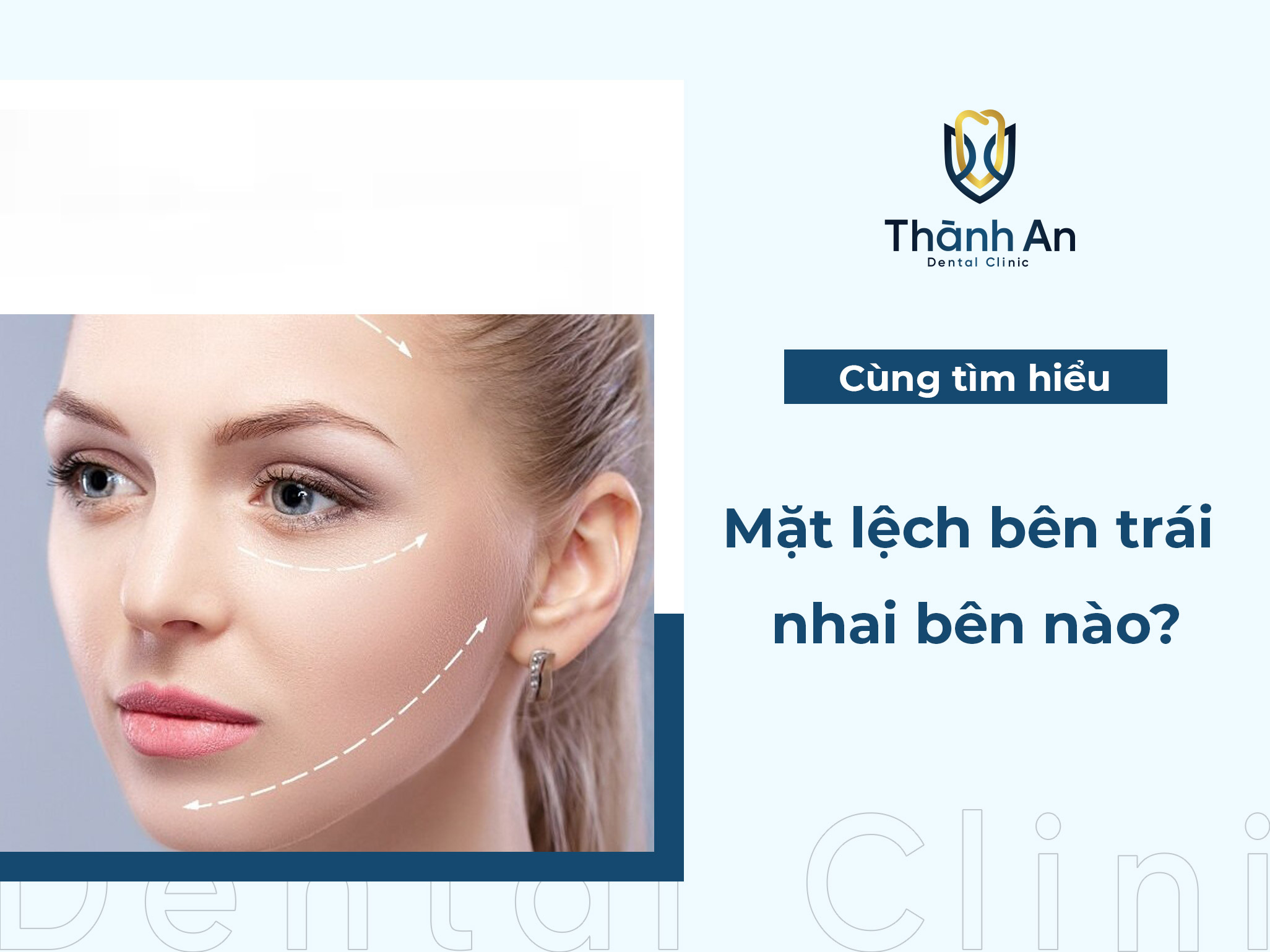 Mặt lệch bên trái thì nhai bên nào để khuôn mặt cân đối 