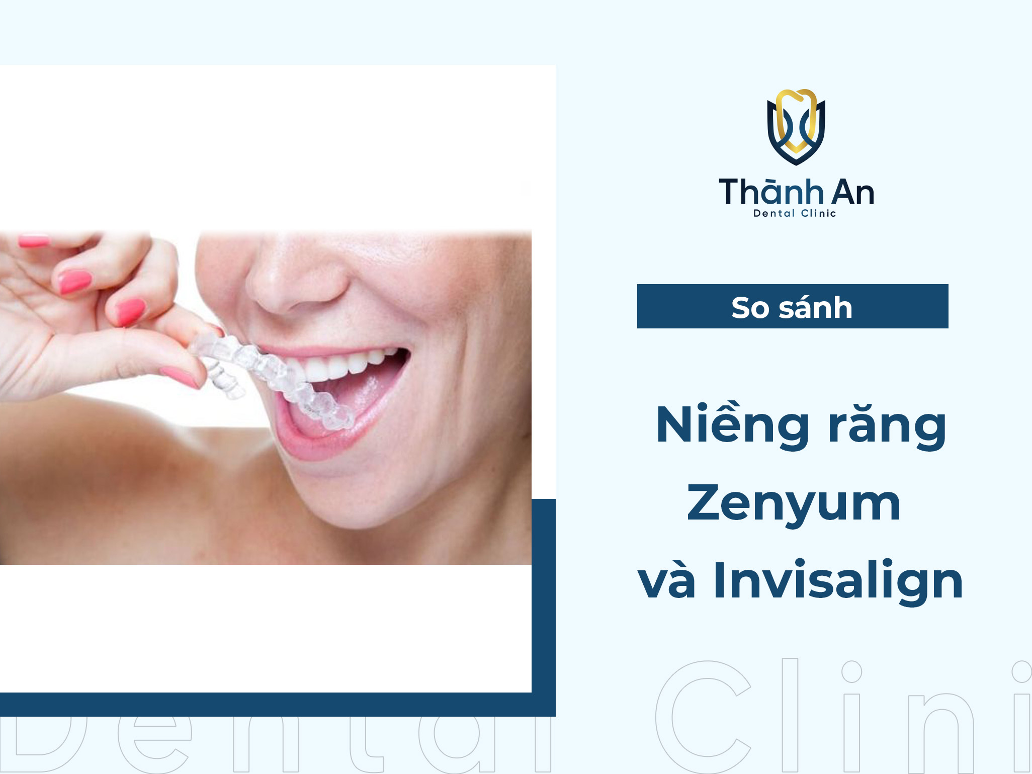So sánh niềng răng Zenyum và Invisalign? nên chọn phương pháp nào?