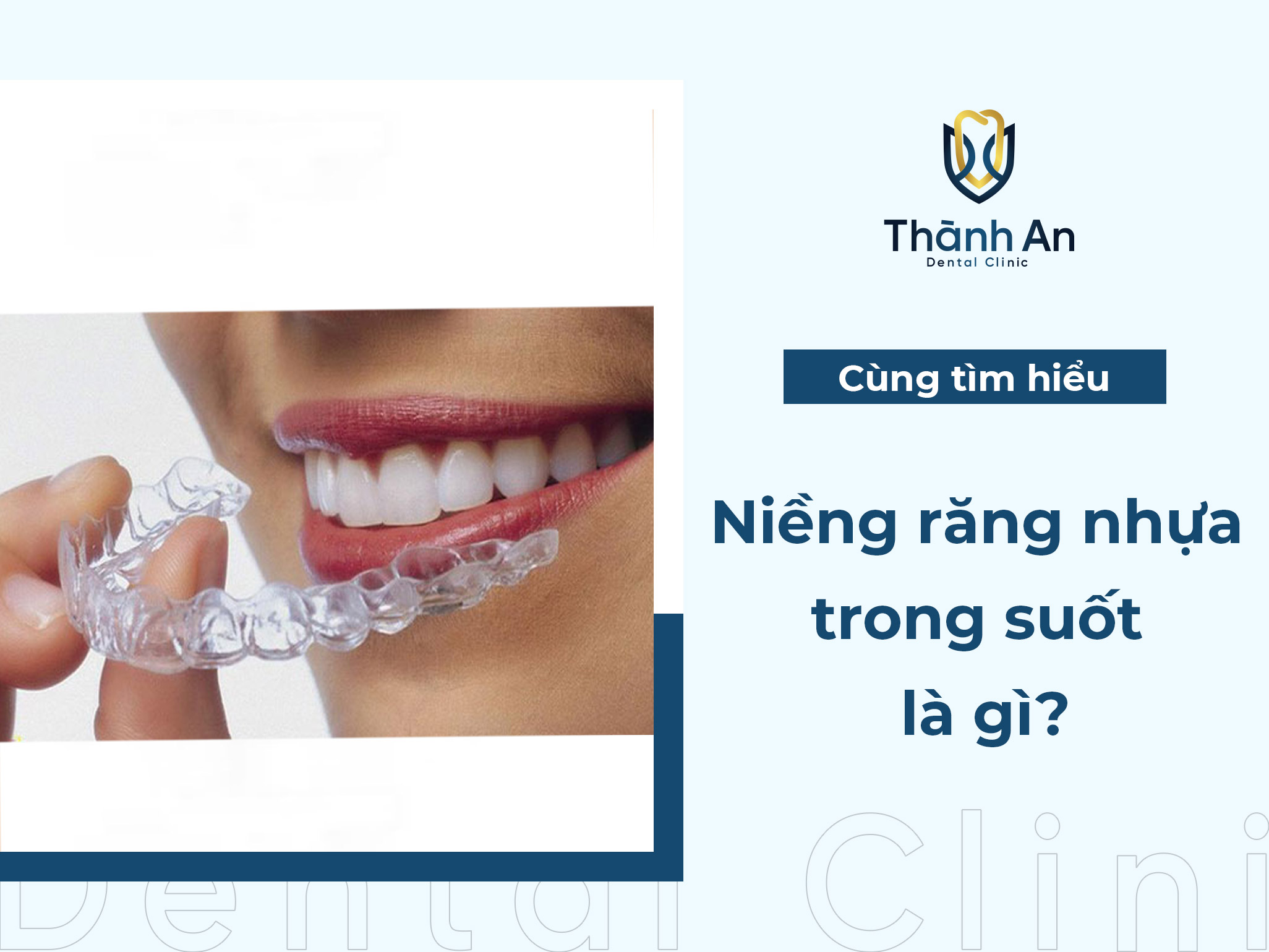 Niềng răng nhựa trong suốt là gì? Có mấy loại để lựa chọn
