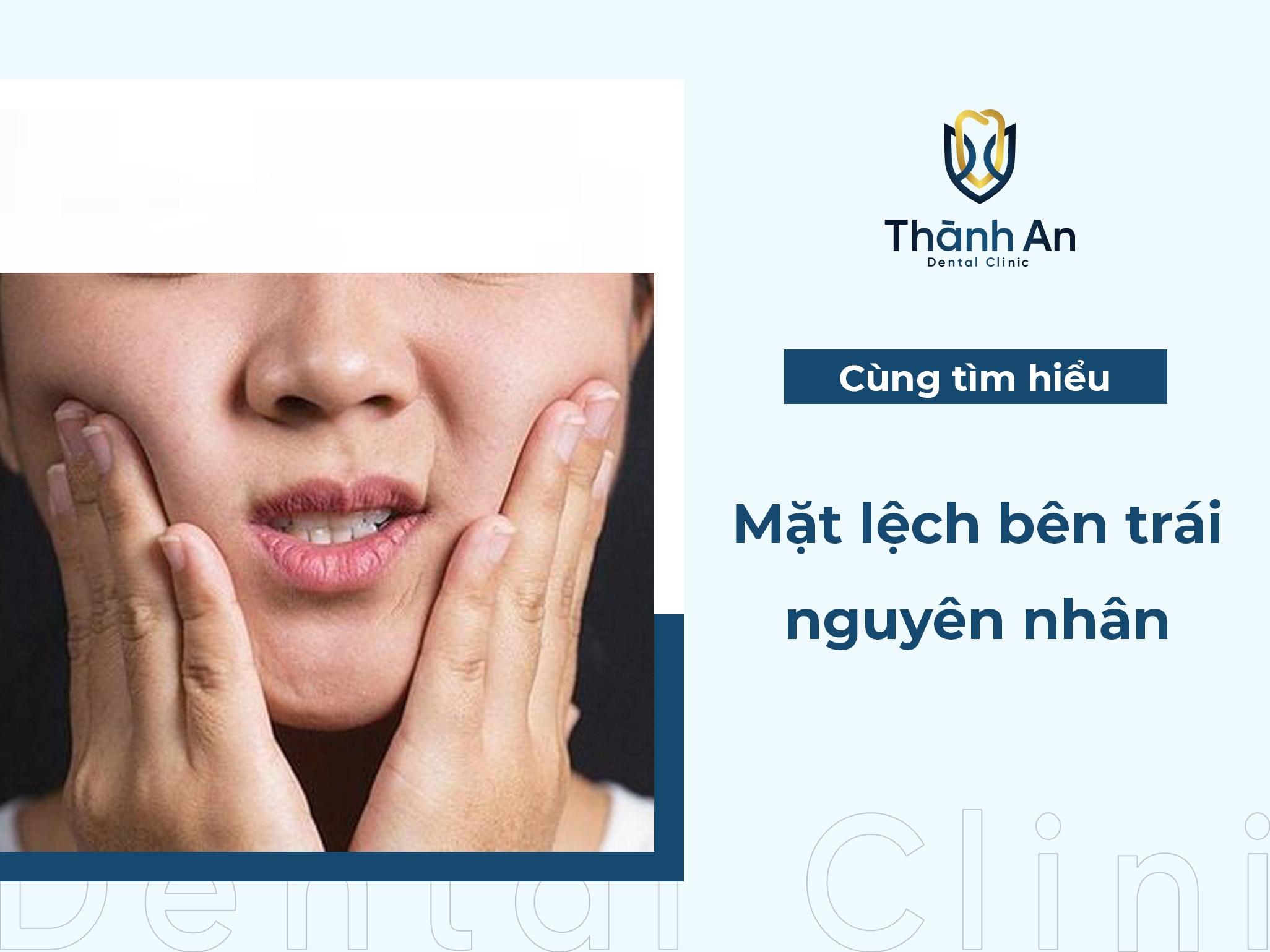 Mặt lệch bên trái: Nguyên nhân và cách khắc phục HIỆU QUẢ