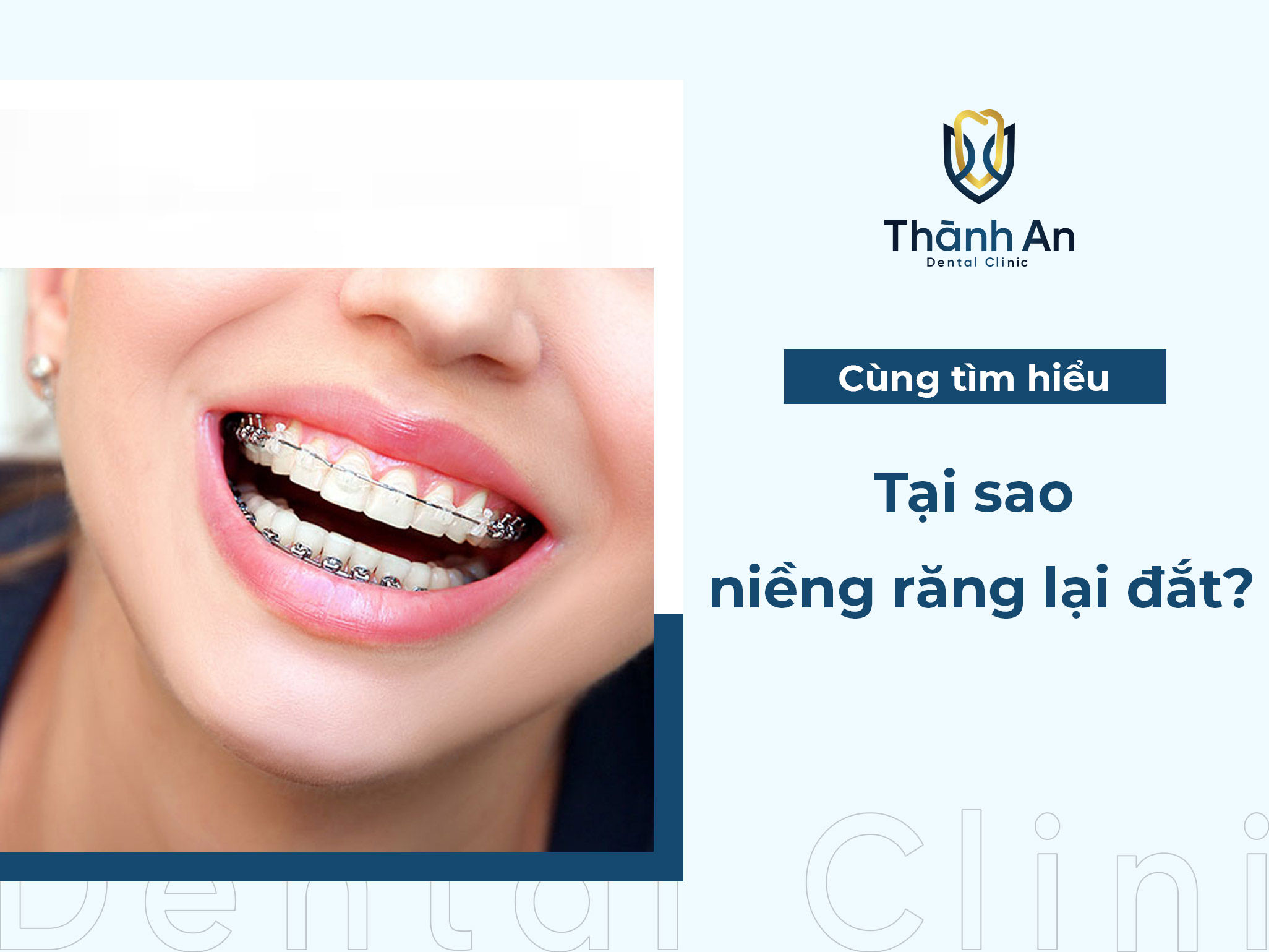 Tại sao niềng răng lại đắt? yếu tố ảnh hưởng chính là gì?