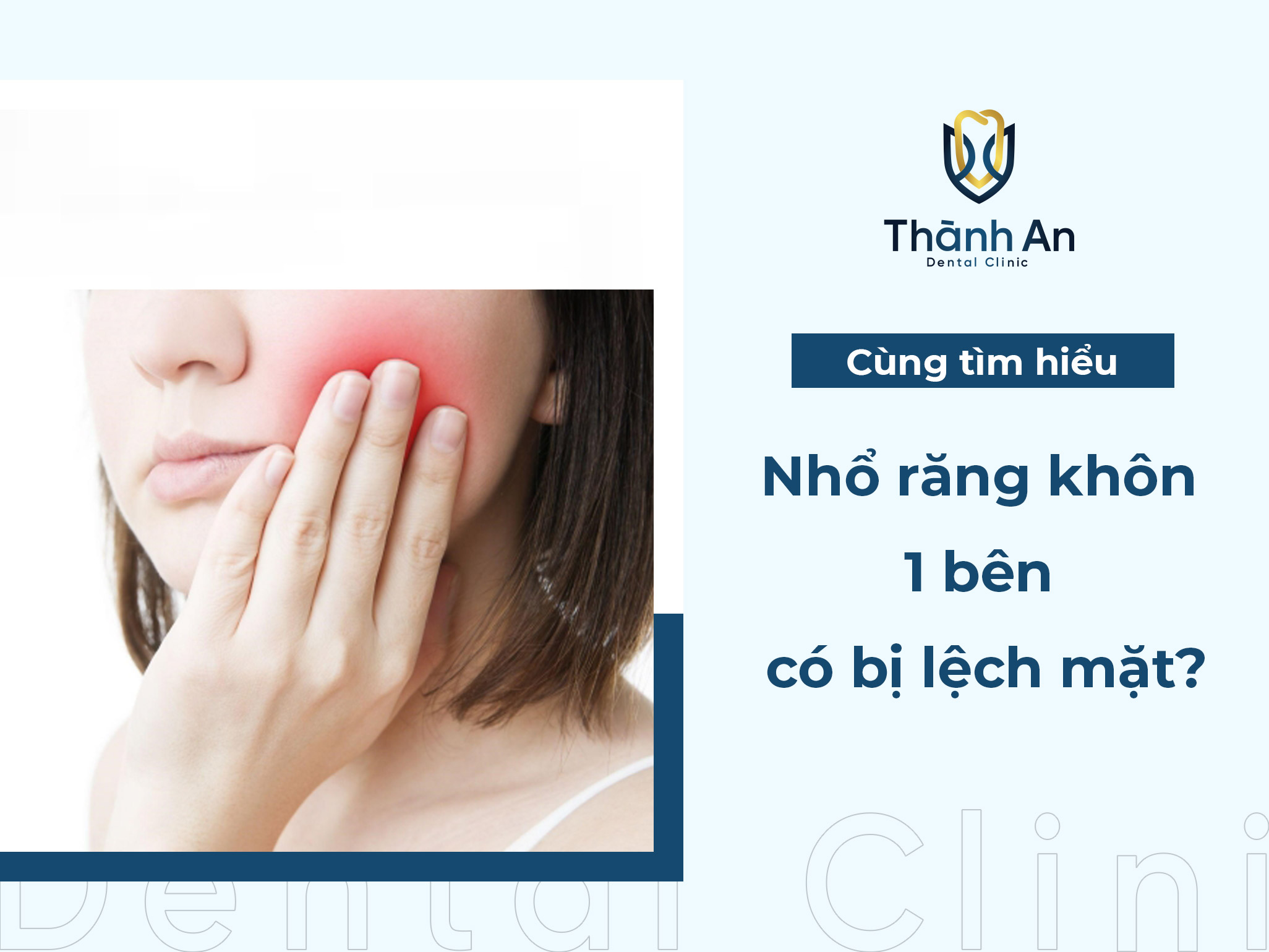 Nhổ răng khôn 1 bên có bị lệch mặt không?