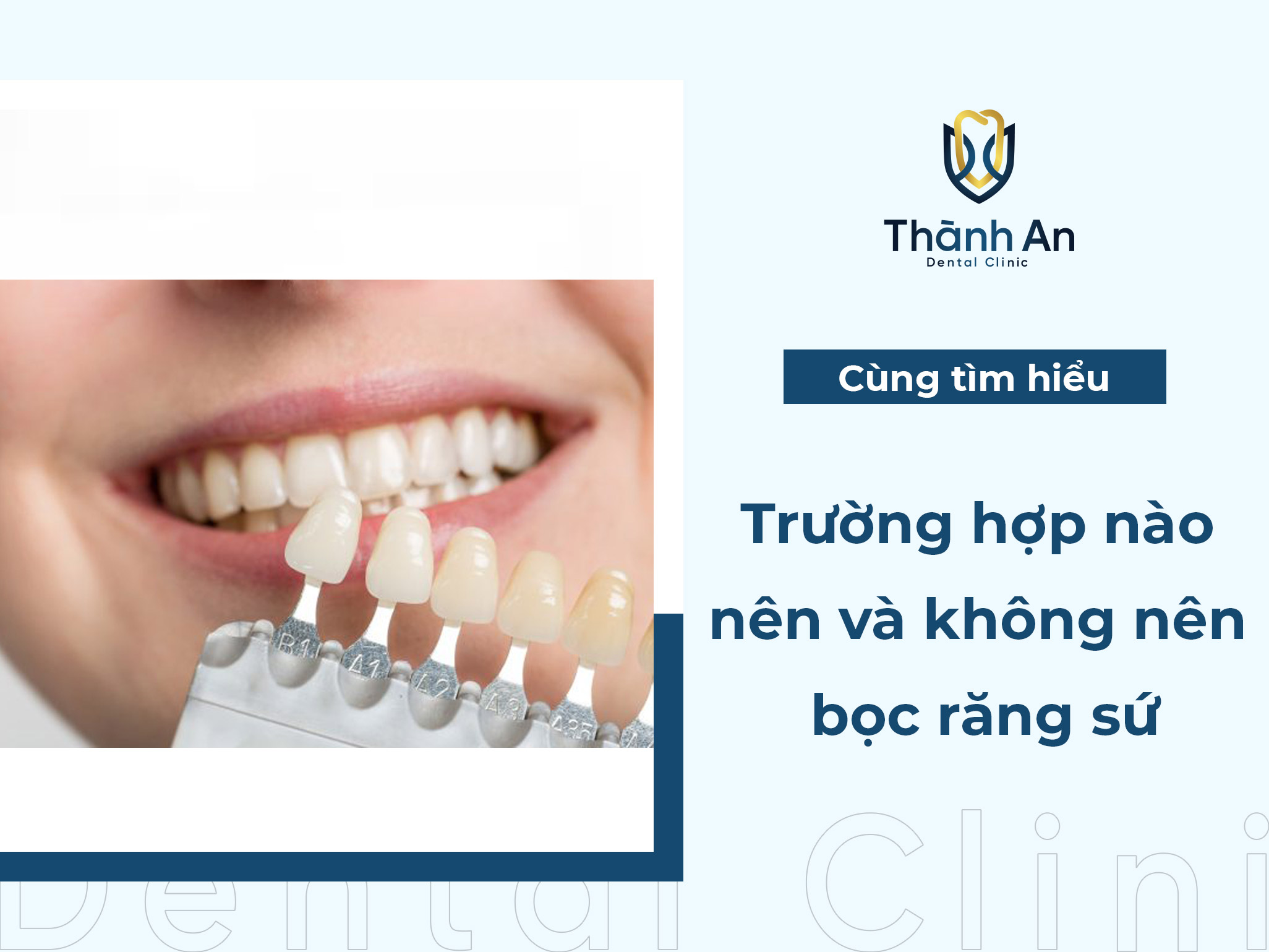 [Hỏi- Đáp] Trường hợp nào nên bọc răng sứ và không nên bọc răng sứ