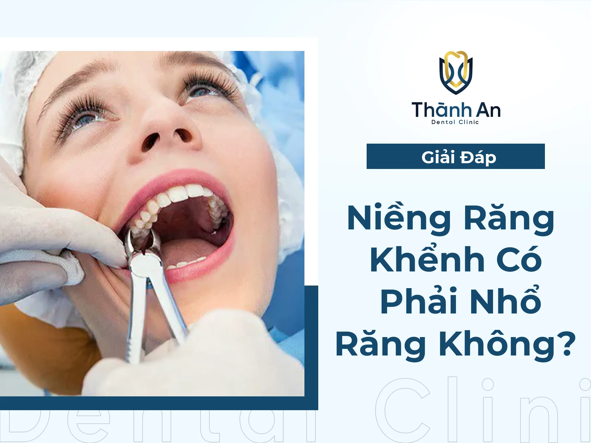 #1 [Giải Đáp] Niềng Răng Khểnh Có Phải Nhổ Răng Không?