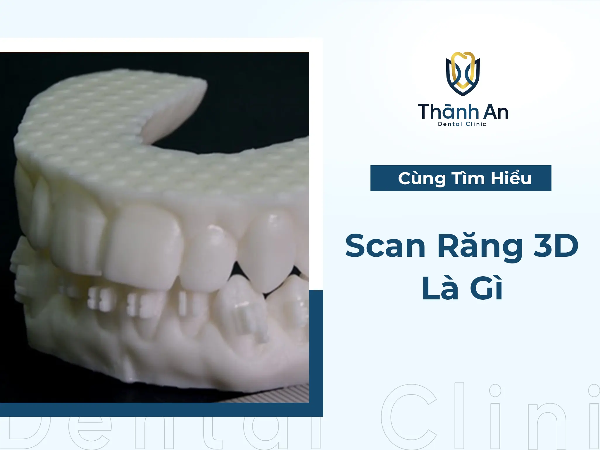 #1 Scan Răng 3D Là Gì? - Công Nghệ Đột Phá Mới Hiện Nay