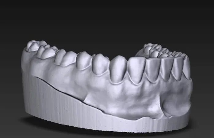 Scan răng 3D