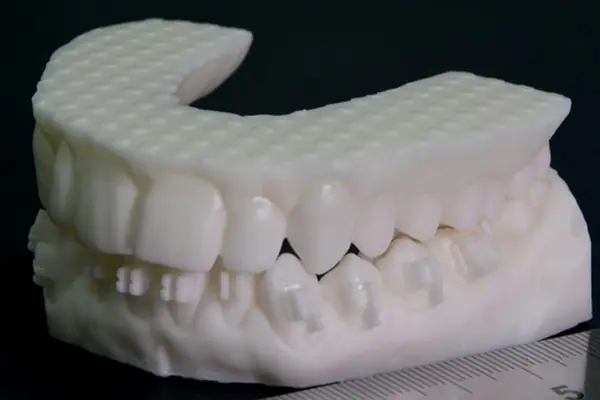 Scan răng 3D
