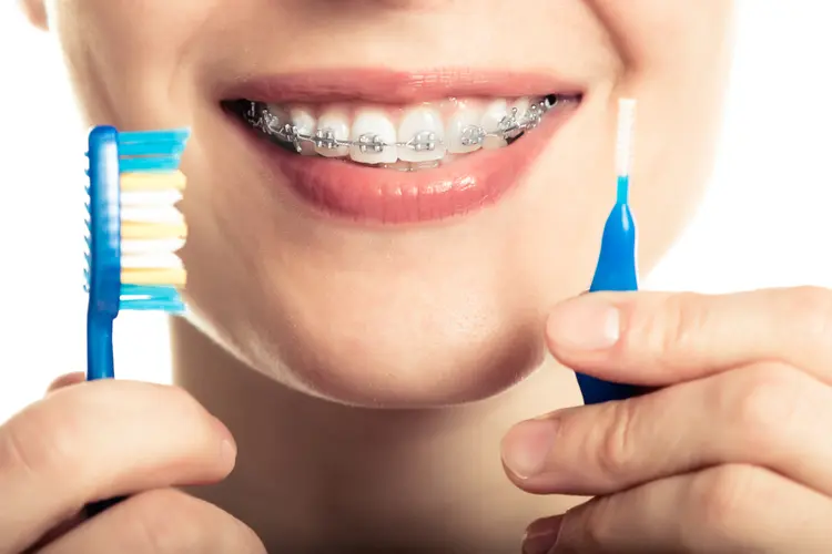 cách chăm sóc răng niềng