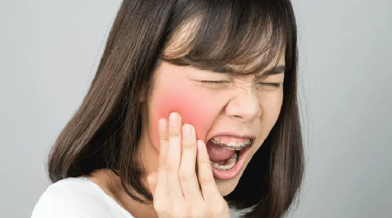 nhổ răng khôn xong bị đau răng bên cạnh
