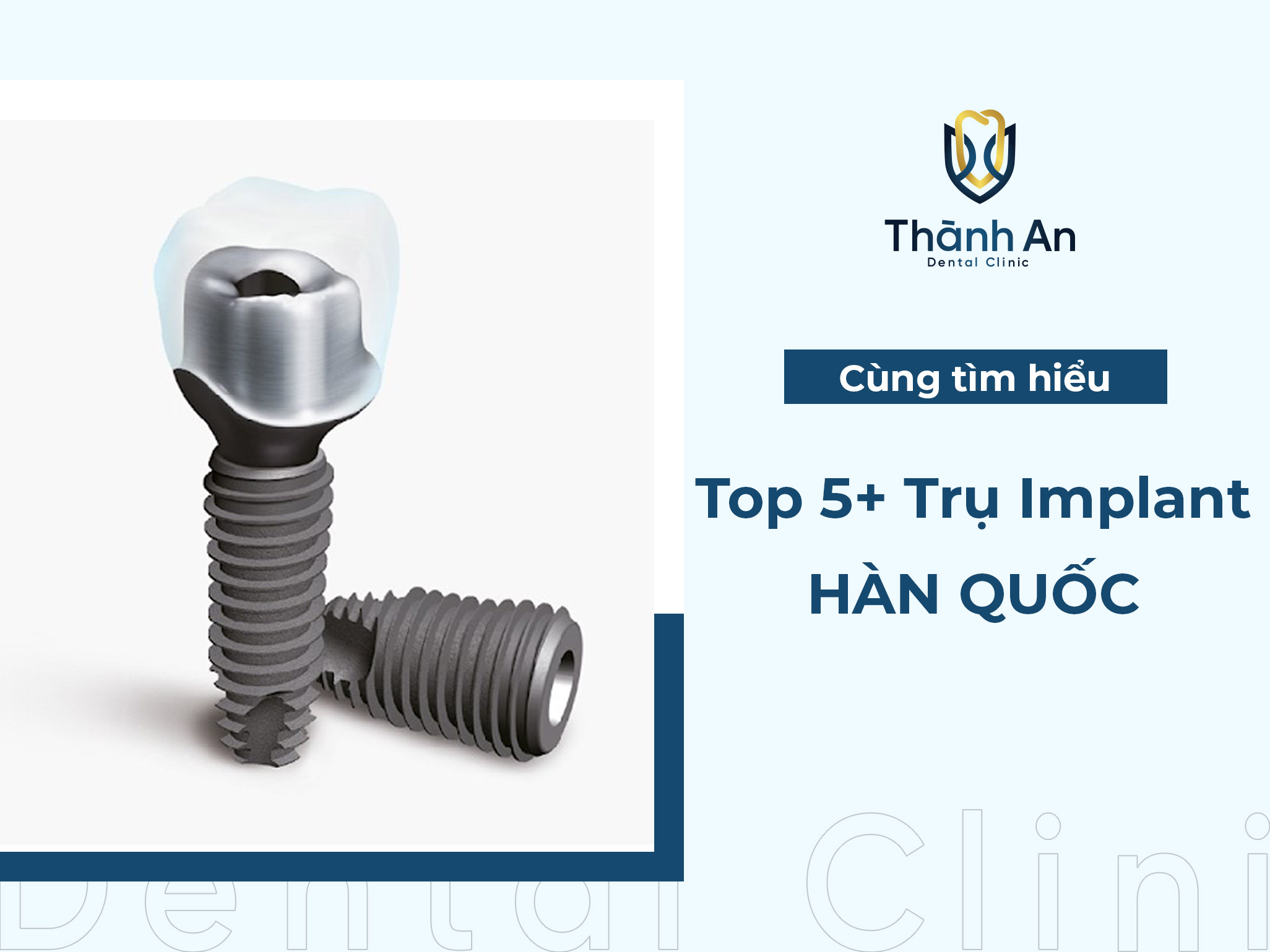 Top 5+ các loại trụ Implant Hàn Quốc phổ biến tại Việt Nam
