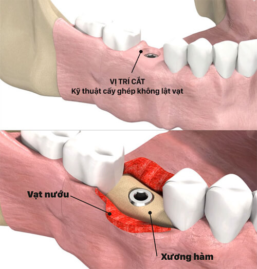 thanh-an
